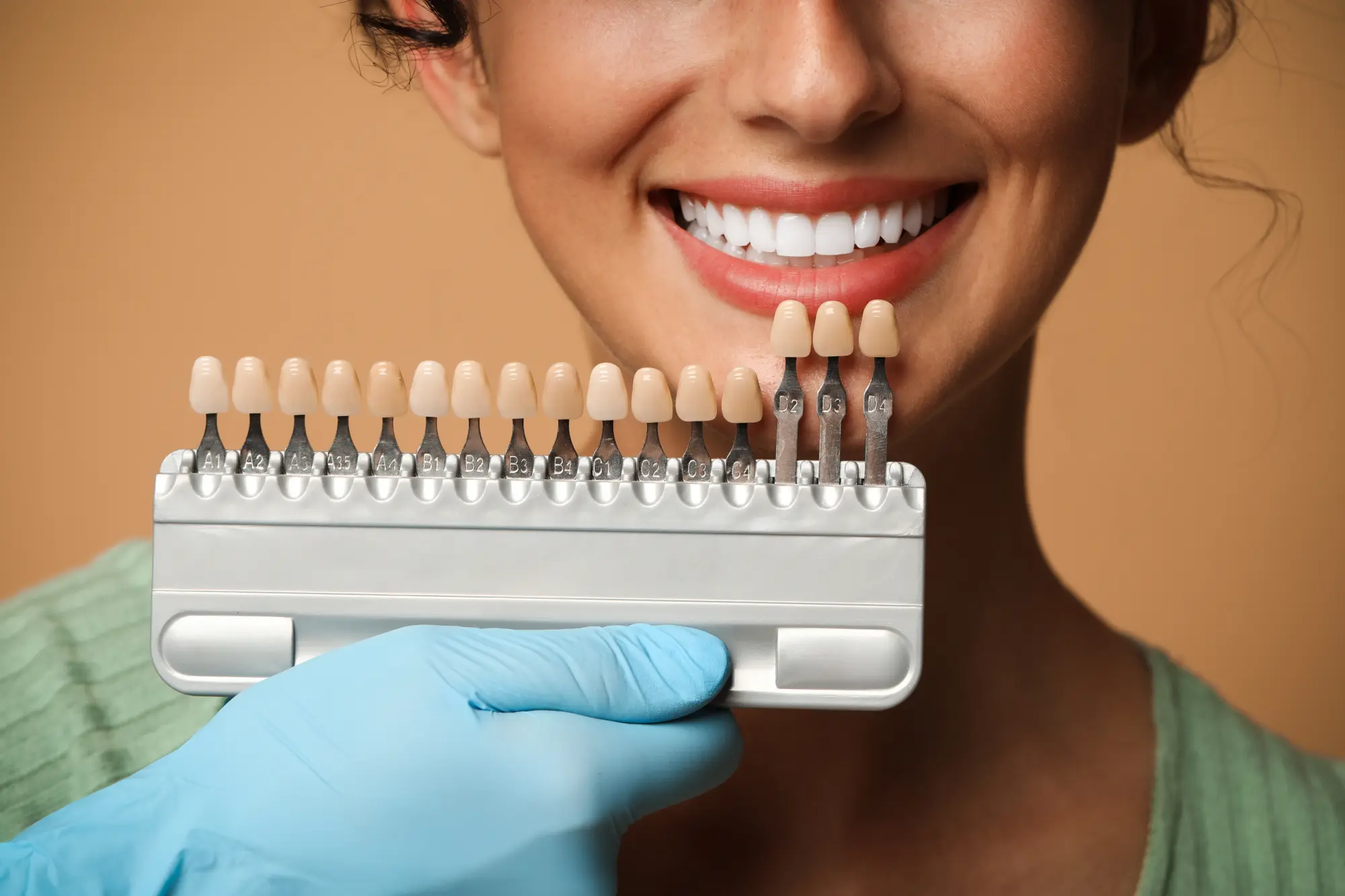Porcelain Veneers in Lyons: Achieve a Radiant, Confident Smile