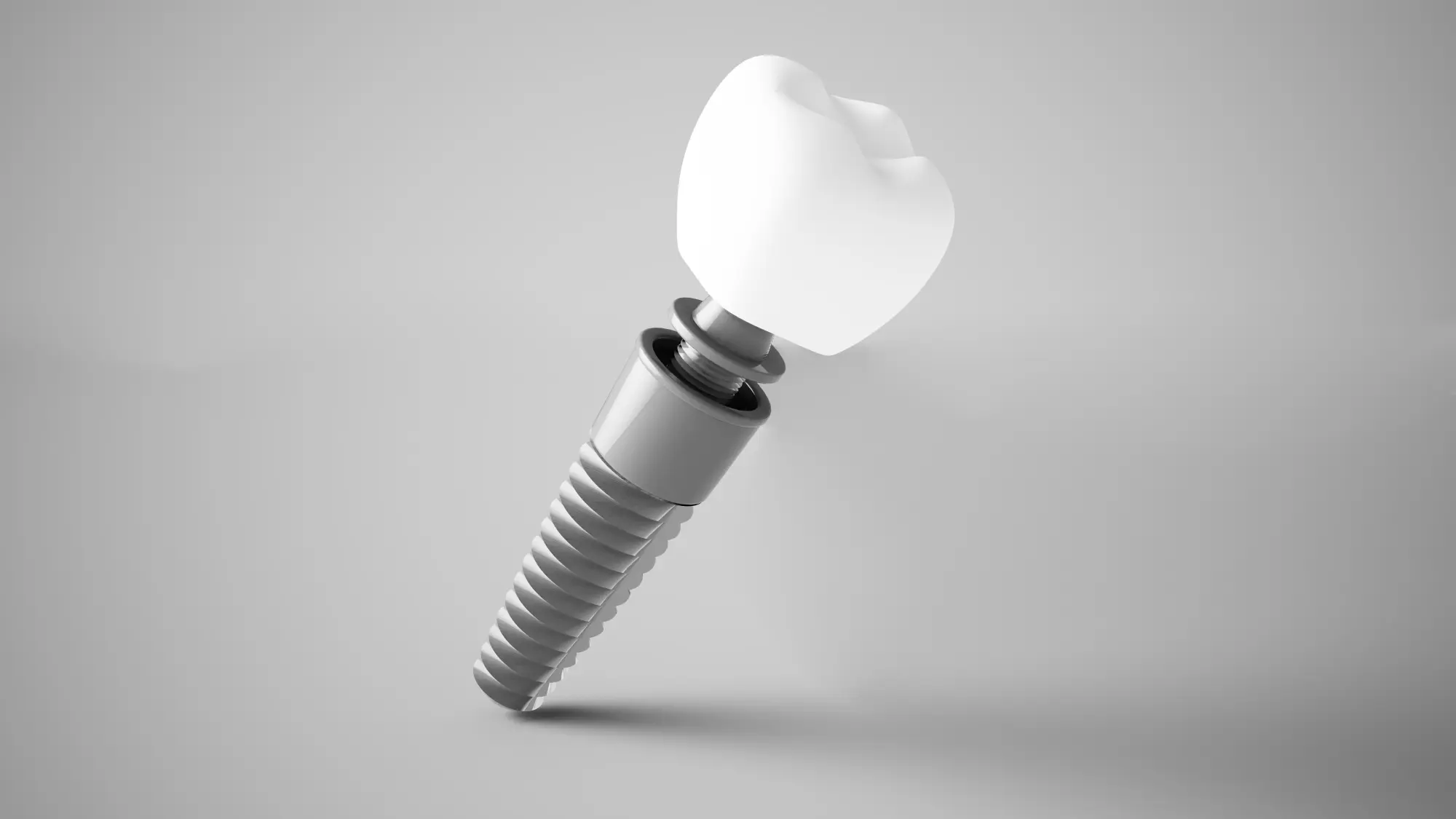 What Happens If a Dental Implant Needs a Crown?