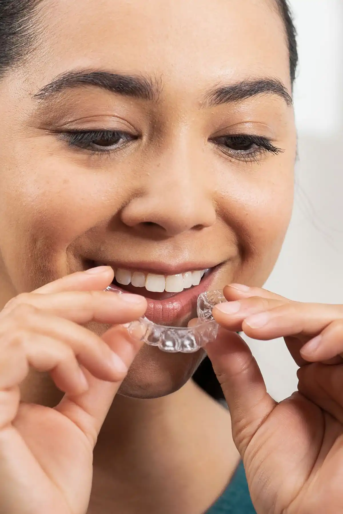 Teeth Straightening