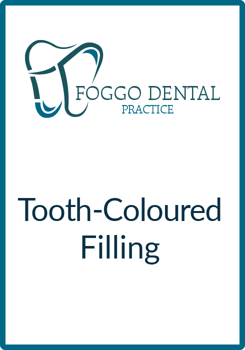 Tooth-Coloured Filling