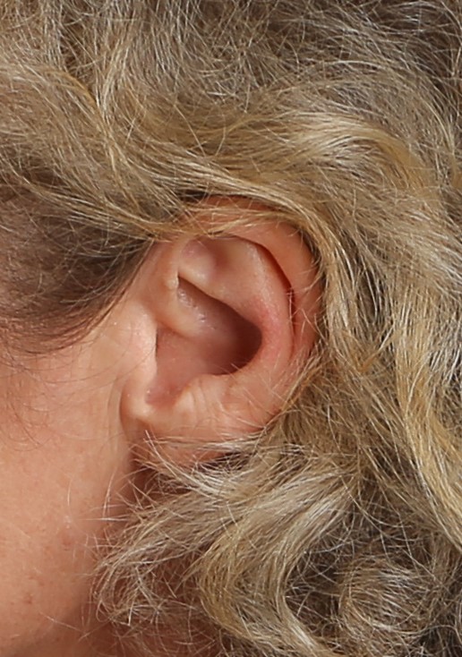 Nahaufnahme des linken Ohres von Heidrun Fischer