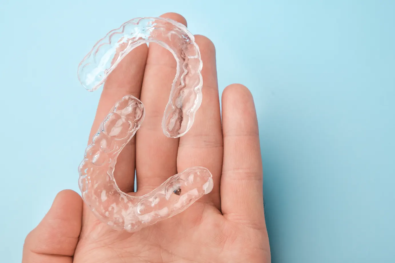 Can Clear Aligners Fix Crowded Teeth?