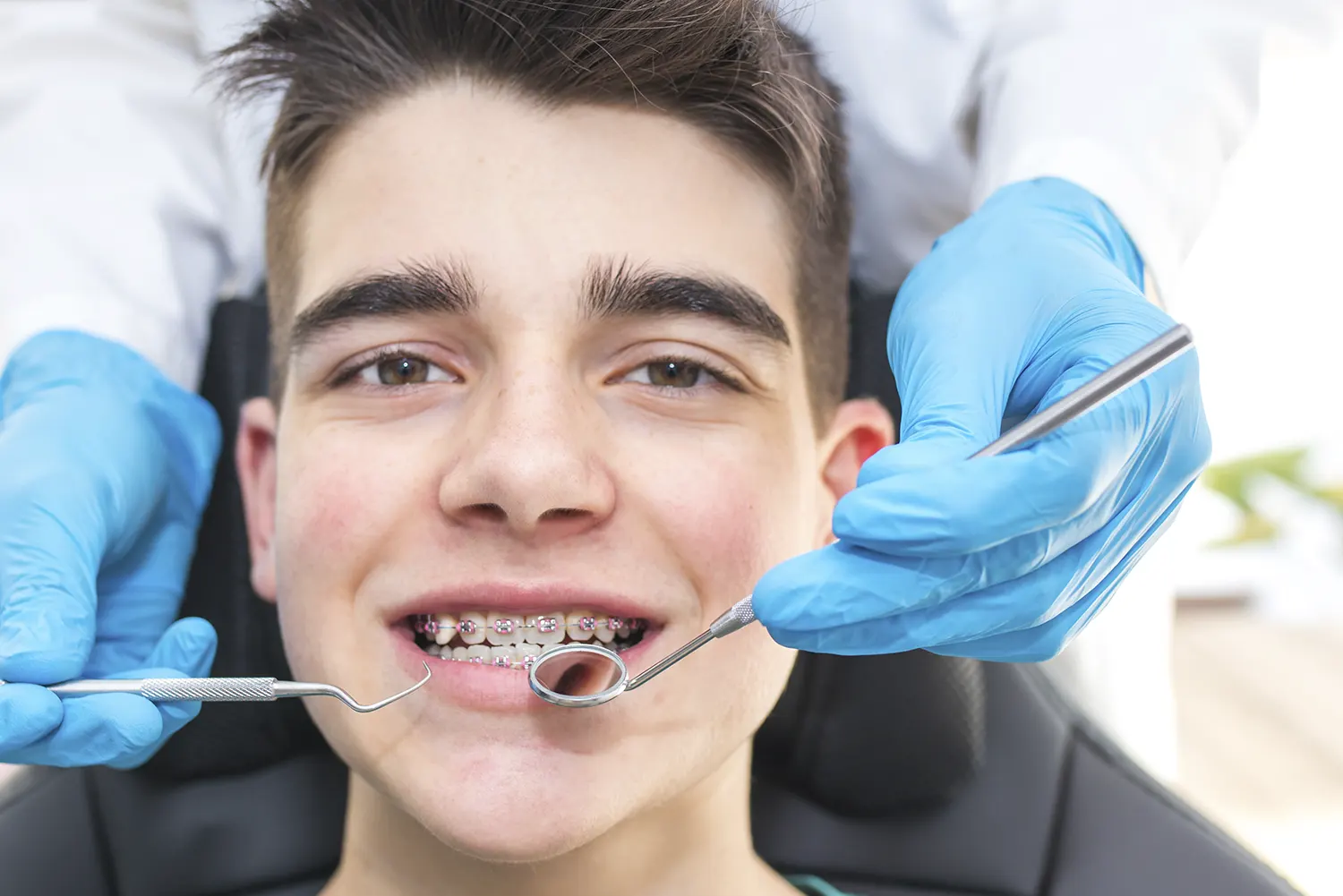 Spring Sports Safety: What to Do in a Braces Emergency in Katy, TX