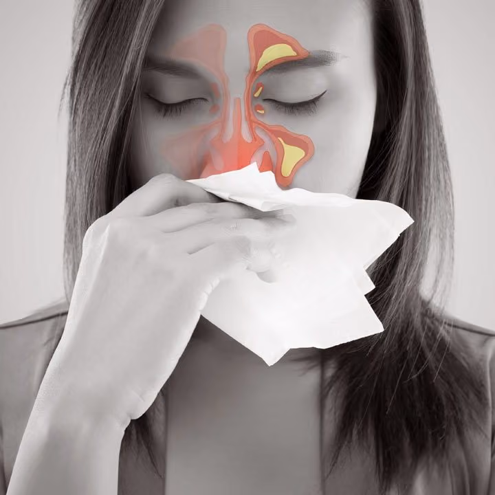 How To Defeat Sinusitis