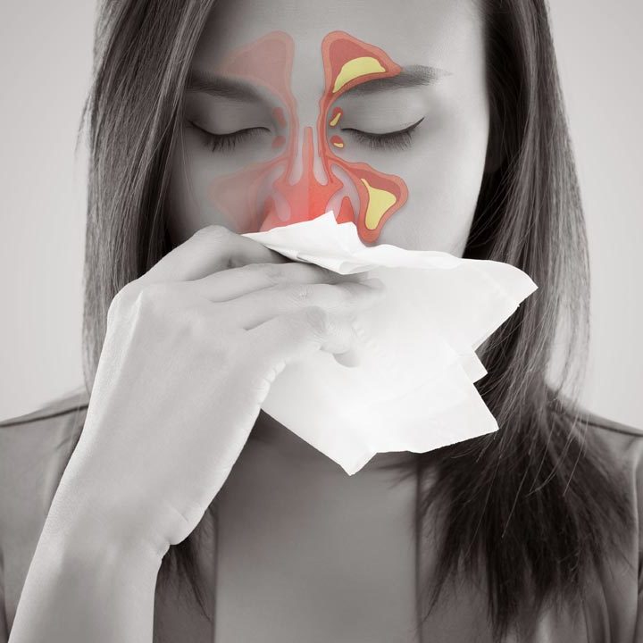How To Defeat Sinusitis