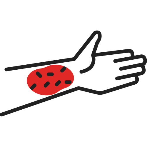 Allergy Icon - 500x500