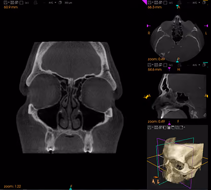 CT Scan Image