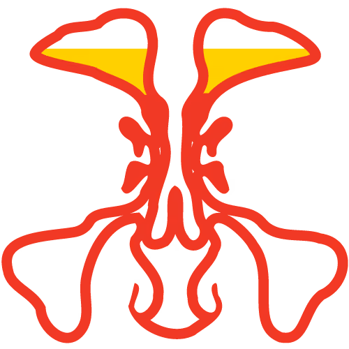 Clogged Sinuses