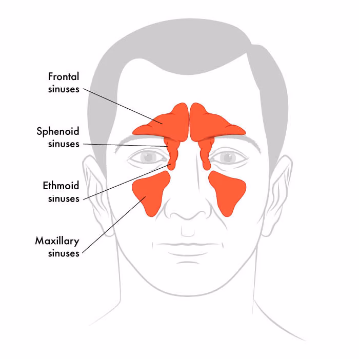 Sinus Diagram