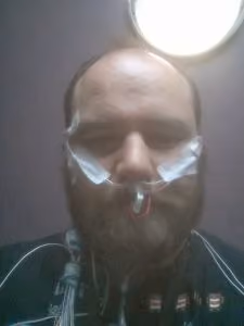 ADVENT Erik Sleep Study