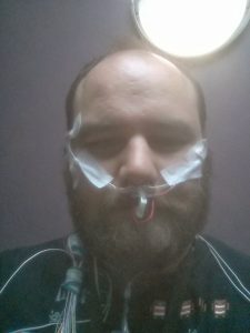 ADVENT Erik Sleep Study