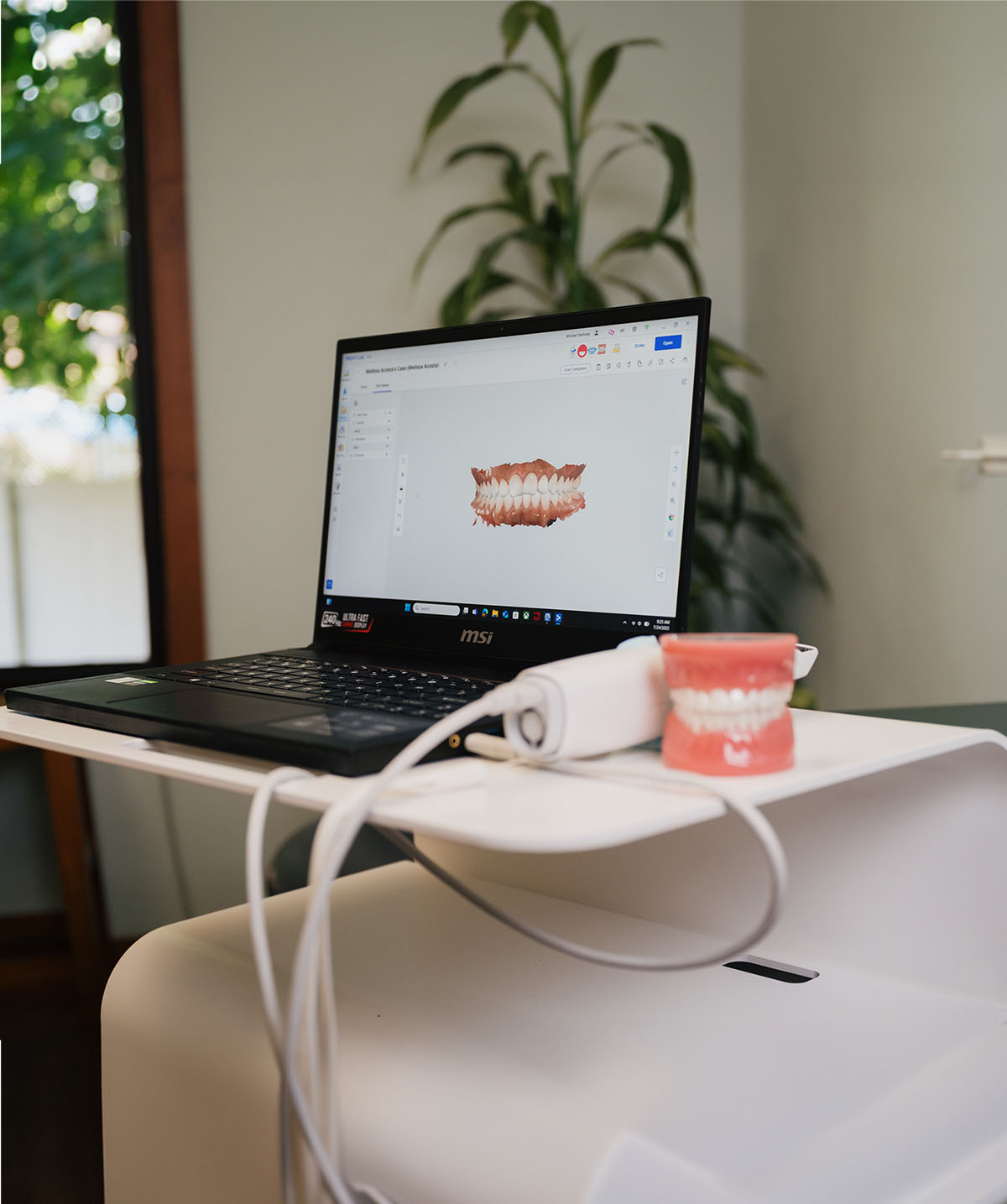 Laptop showing a 3D digital dental model of teeth with a dental scanner and model teeth on a white tray.