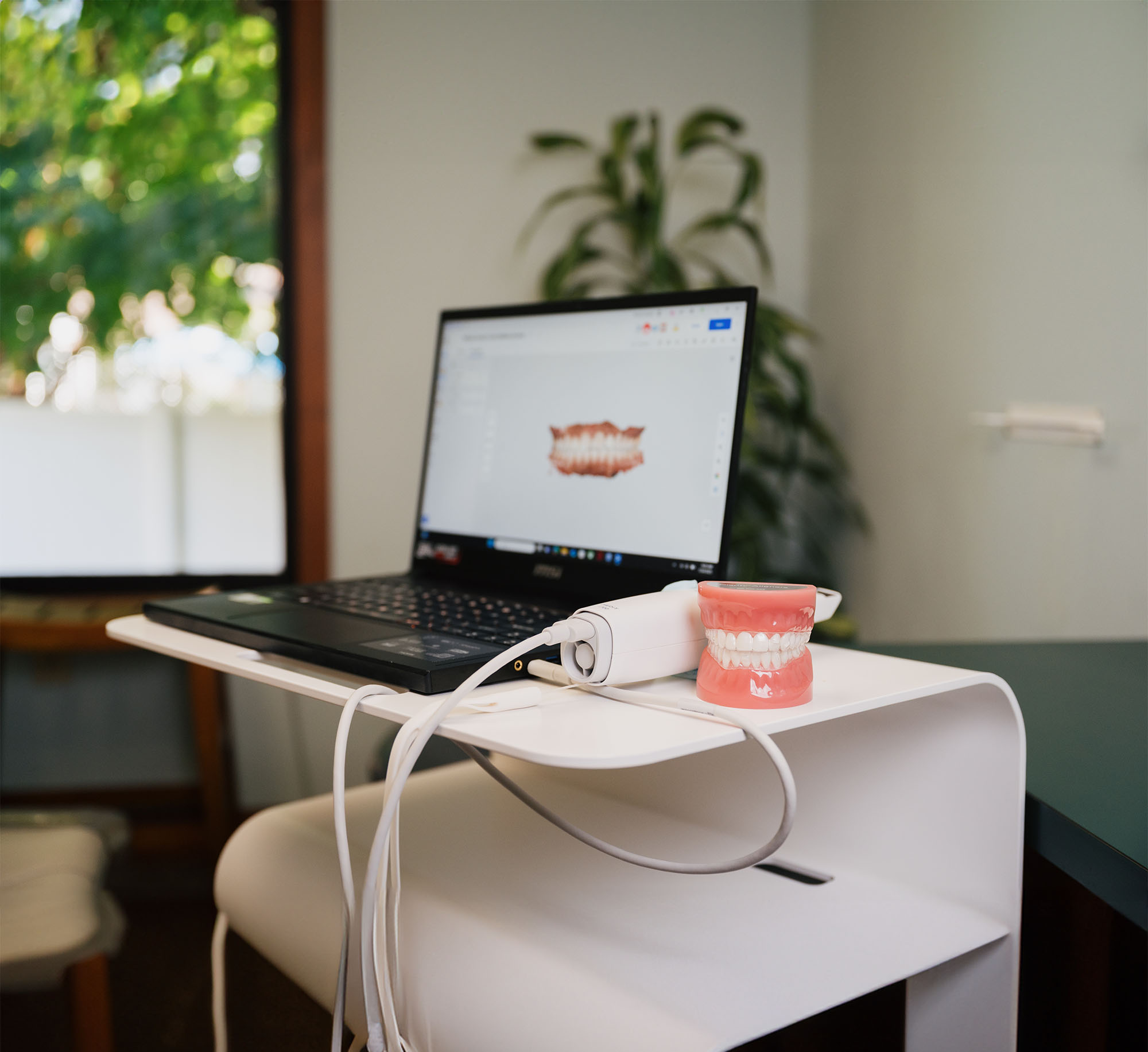 Dental model and scanning device connected to a laptop showing a 3D teeth model on the screen.