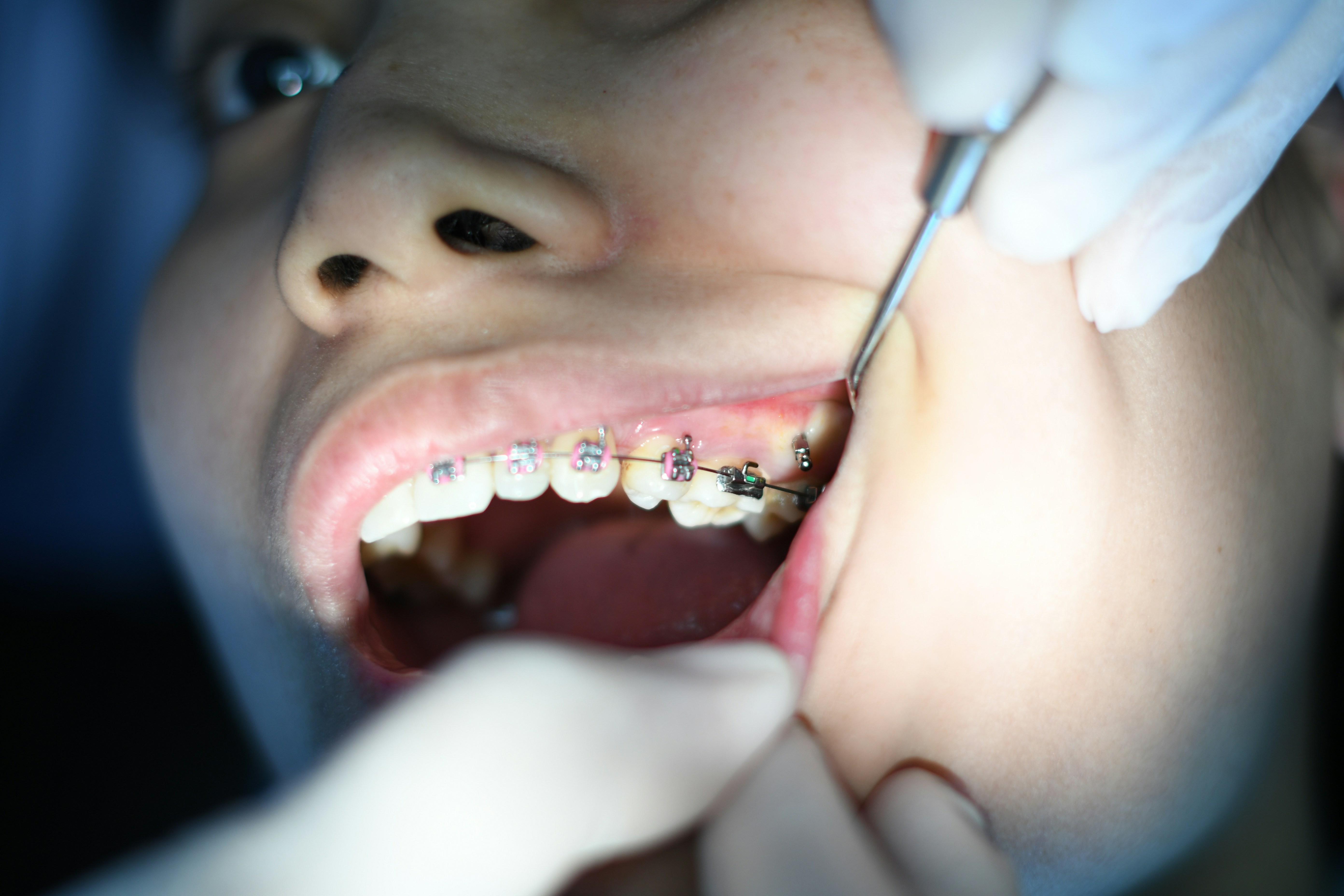 tooth and mirror tool