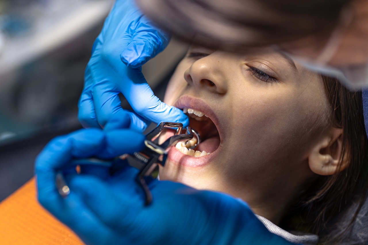 Orthodontist adjusting a palatal expander in San Marcos