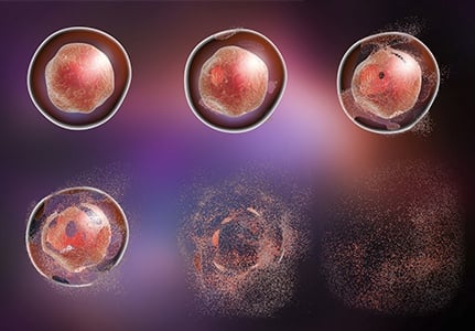 Alkaline Lysis vs. High Pressure Homogenization: Which is Better?