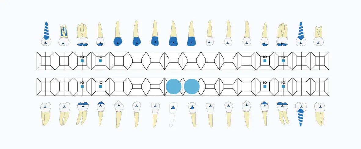Interactive dental chart showing colour-coded diagnoses, planned treatments, and completed procedures in a single view
