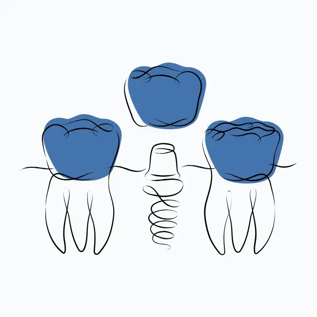 Dental treatment plan templates and implant illustrations used to build reusable clinical plans