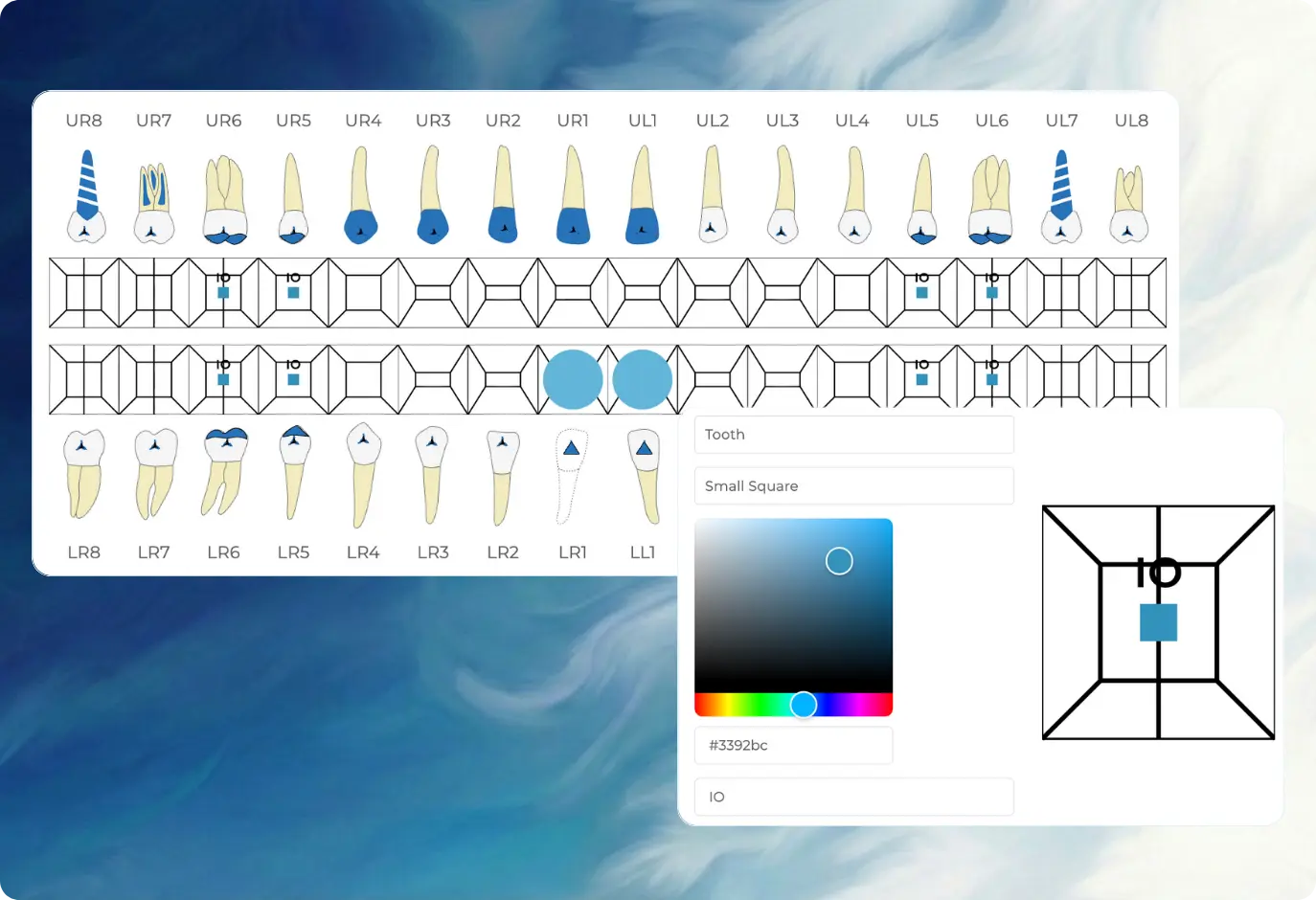 Interactive dental charting interface with colour-coded teeth, diagnoses, and treatment annotations