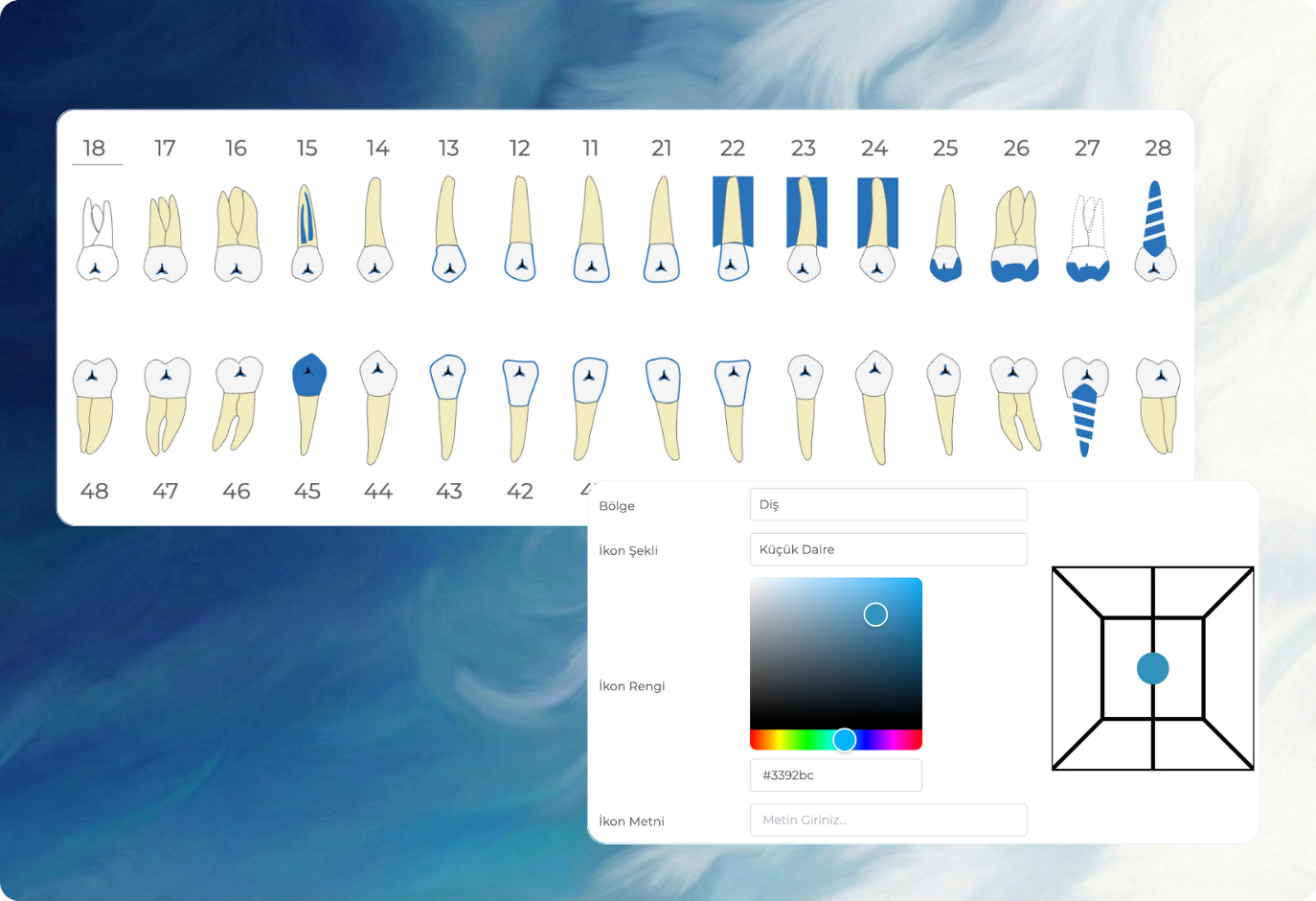 Renk kodlu dişler, teşhisler ve tedavi açıklamalarını içeren etkileşimli diş haritalaması arayüzü
