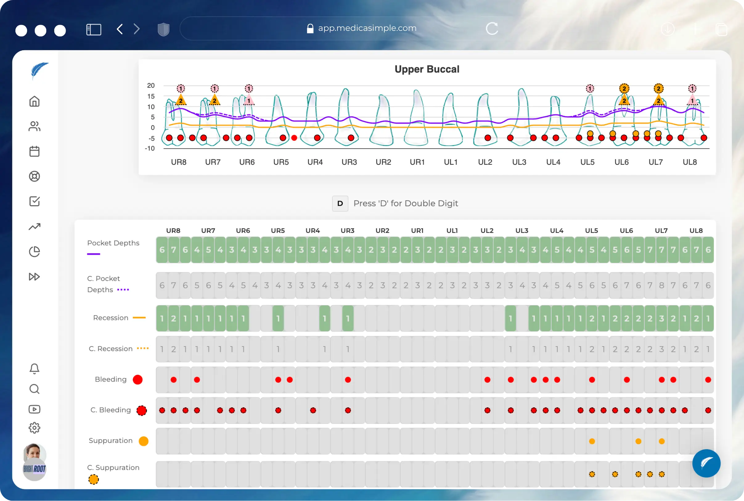 Dental practice management software interface showing interactive dental charting, treatment plans, clinical notes, and completed dental treatments in one dashboard