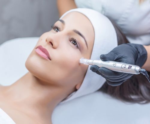 Is Plasma Pen better than Microneedling?