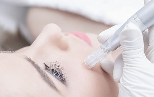 Microneedling Course