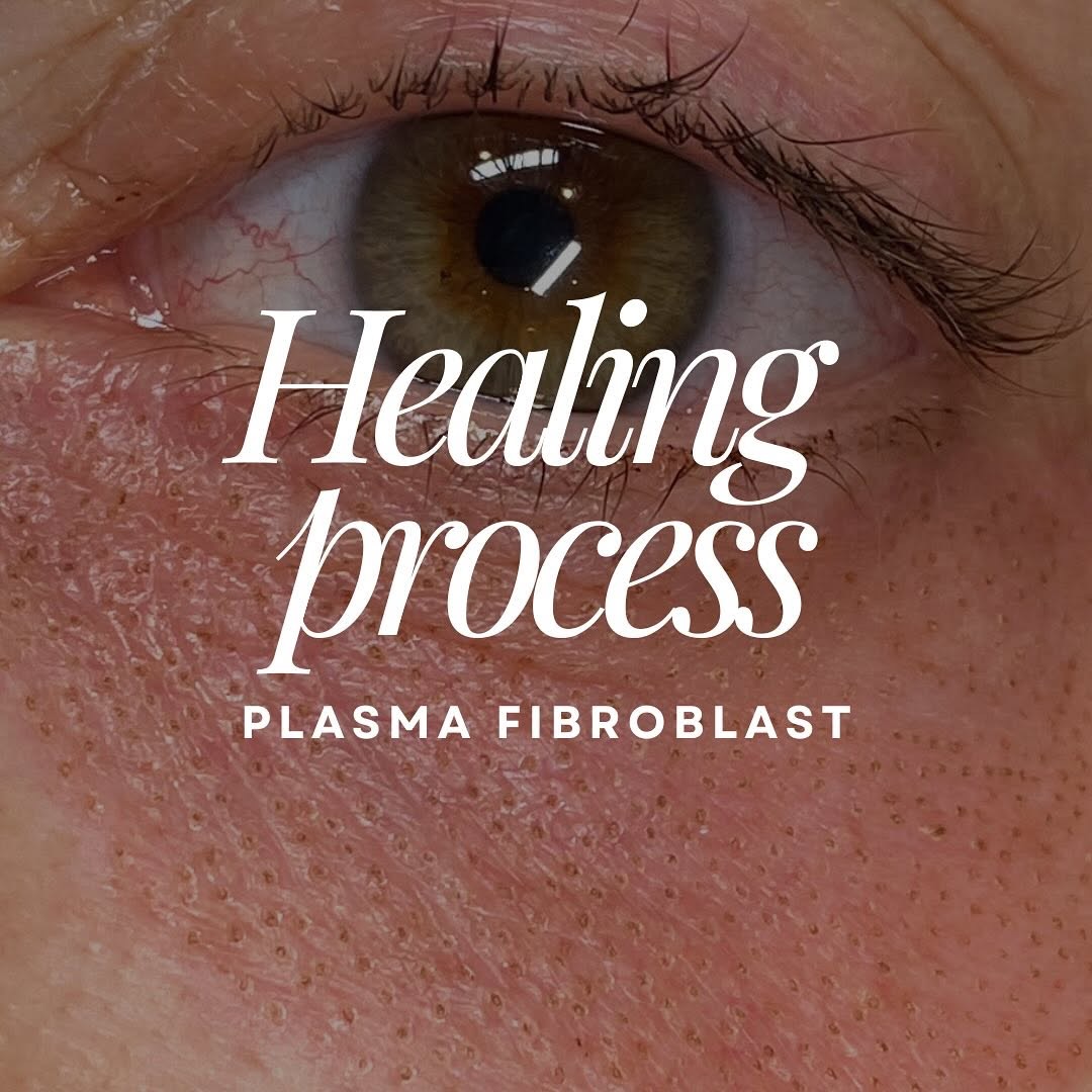 Plasma Fibroblast Healing Process: From Day 1 to Final Results