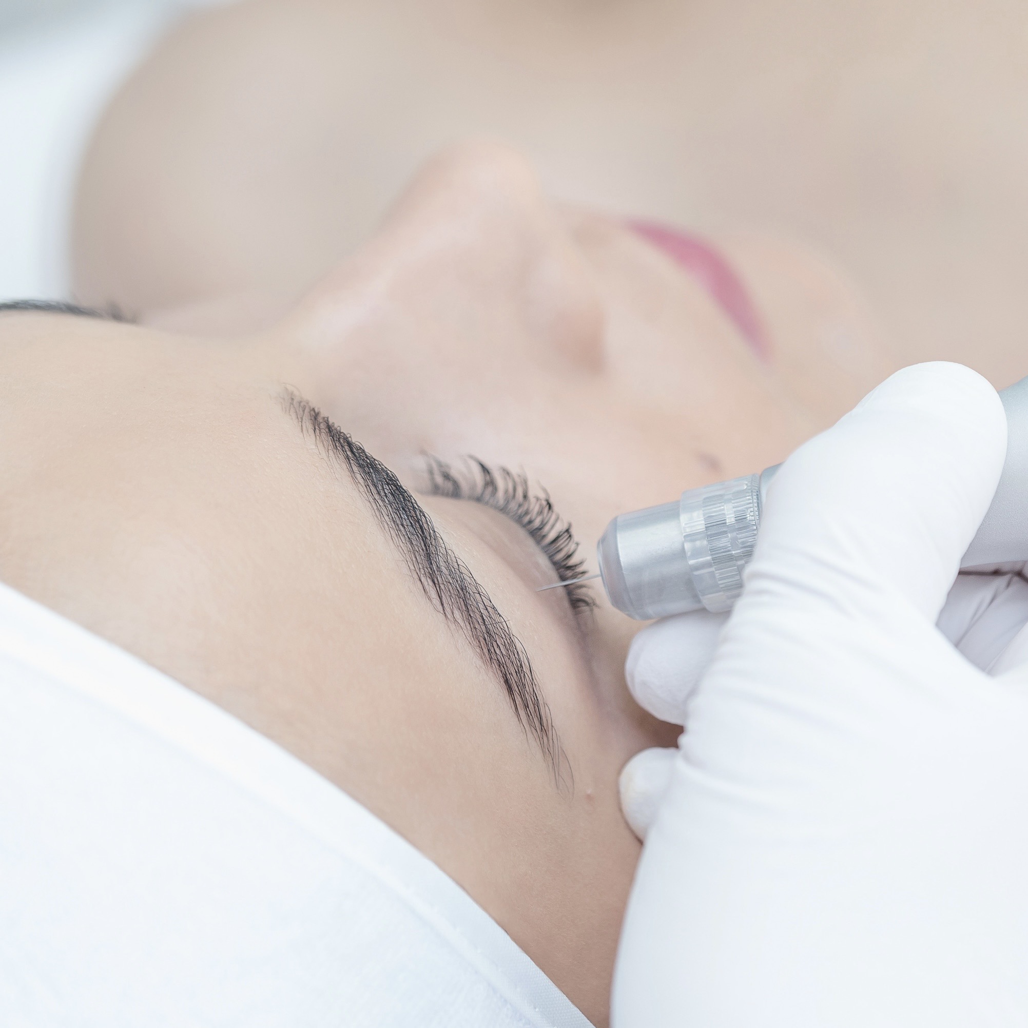 How Much Does Plasma Pen Treatment Cost?