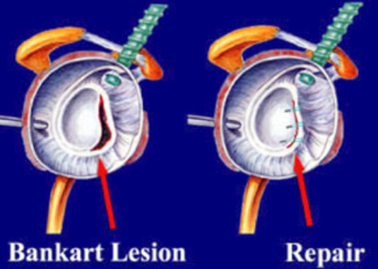 Ziekenhuis St Jansdal