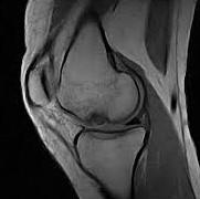 Afbeelding met röntgenfilm, zwart, Medische beeldbewerking, zwart-witAutomatisch gegenereerde beschrijving