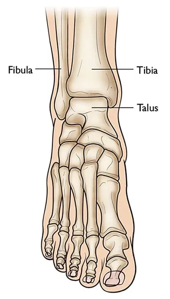 Pilonfractuur: medisch beeld bij Orthopedie Turnhout.