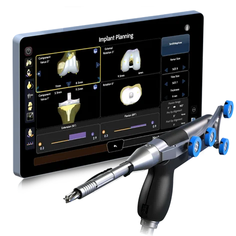 Een chirurgisch handinstrument naast een scherm met een 3D-beeld van de knie en het operatieplan