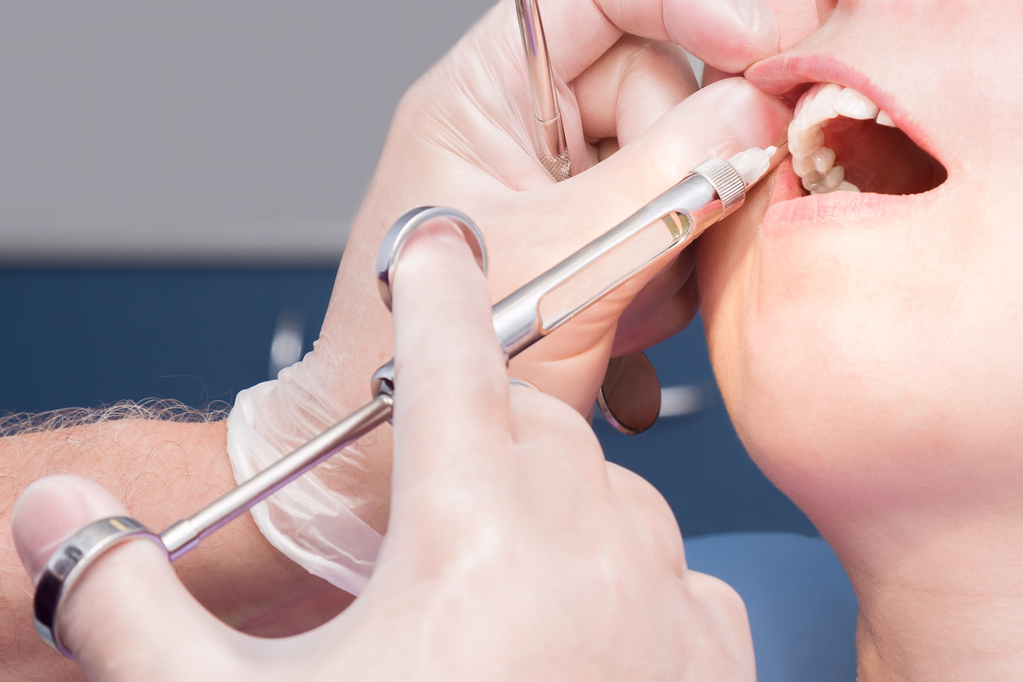 IV Sedation & Dental Anesthesia in Merrillville, IN