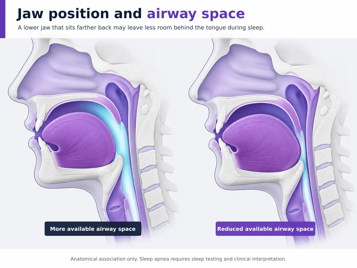 jaw position