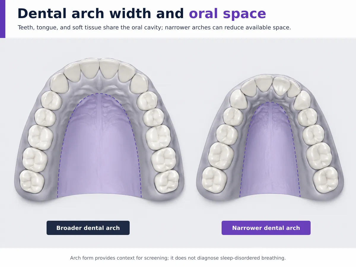 Dental arch