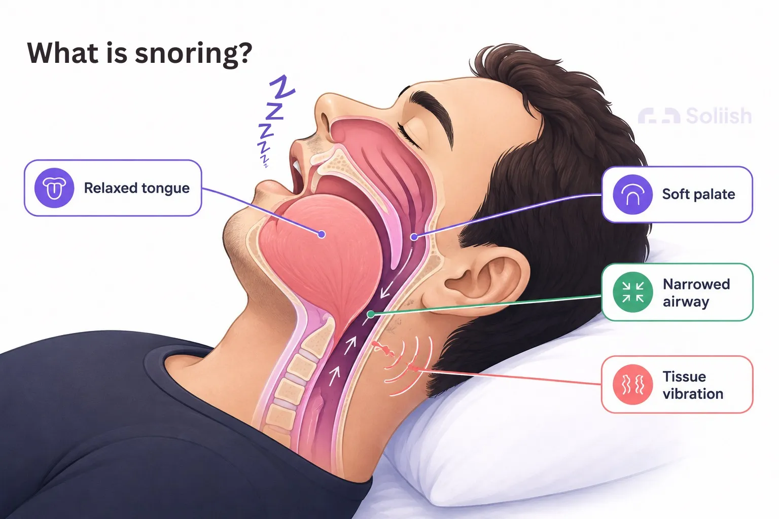 what is snoring