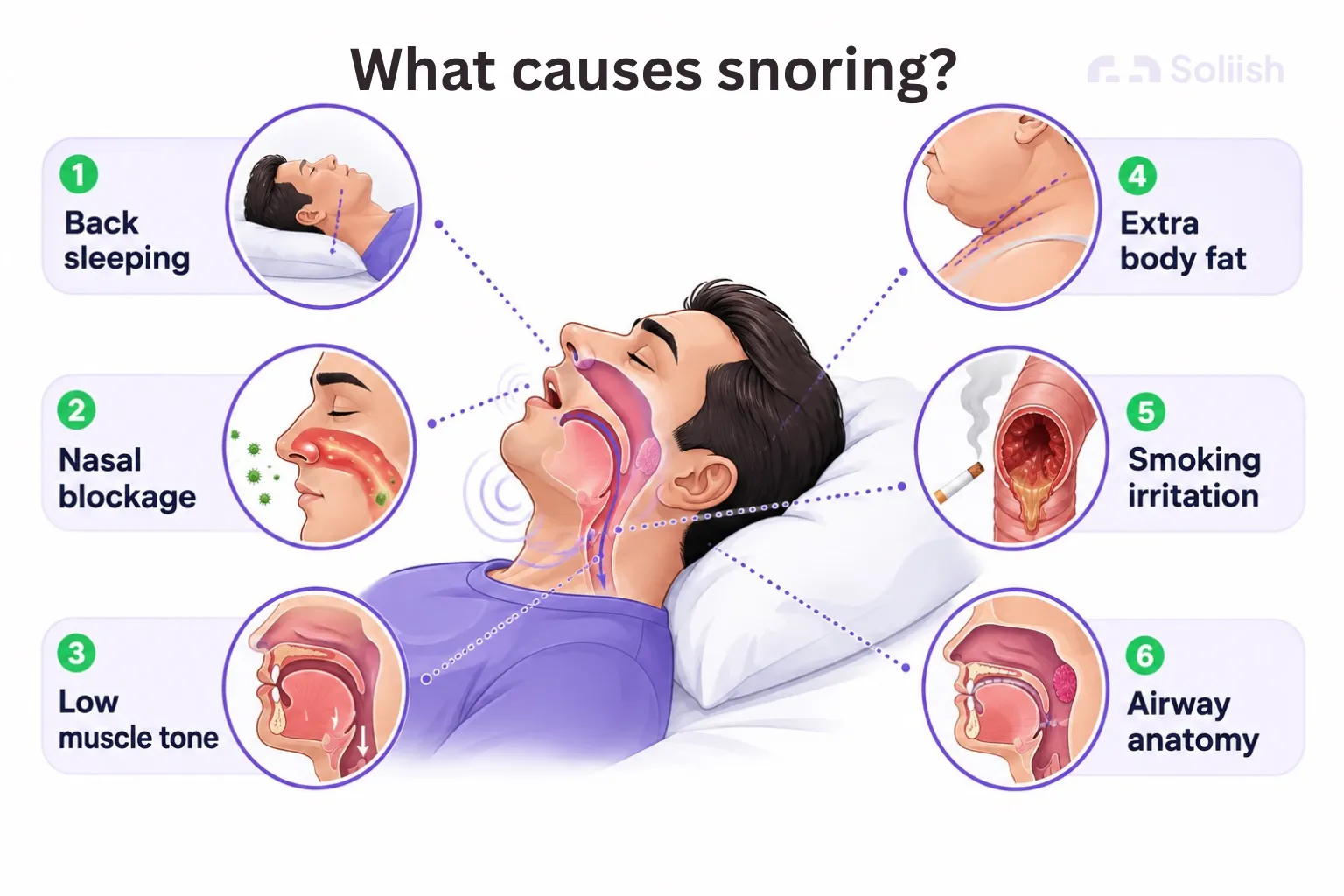 what causes snoring