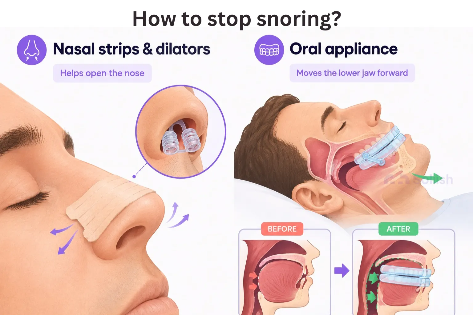 how to stop snoring figure 4