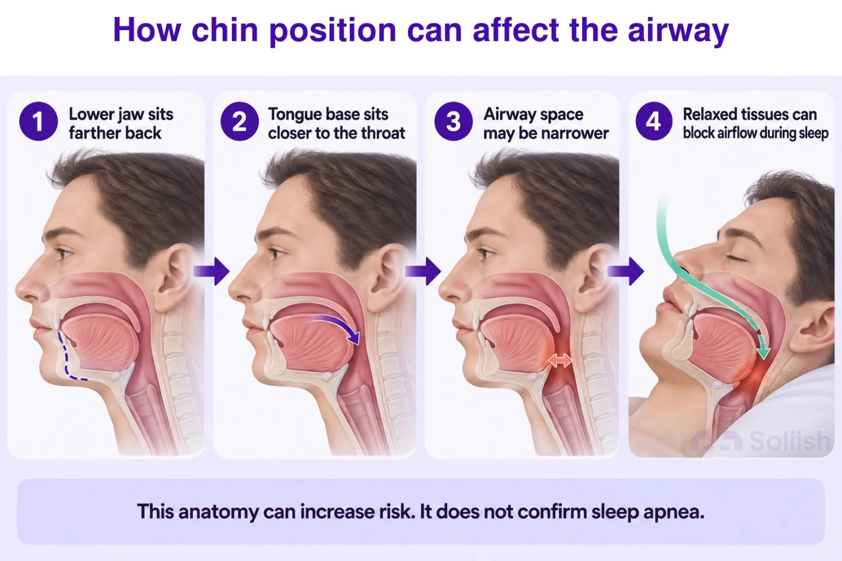 how chin position can affect the airway