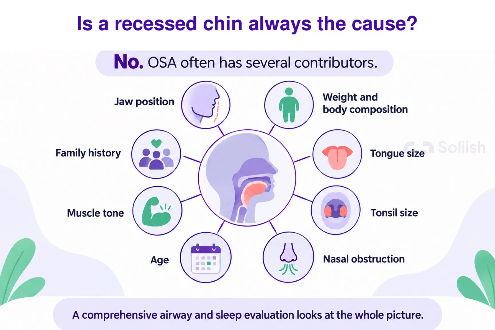 is a recessed chin always the cause
