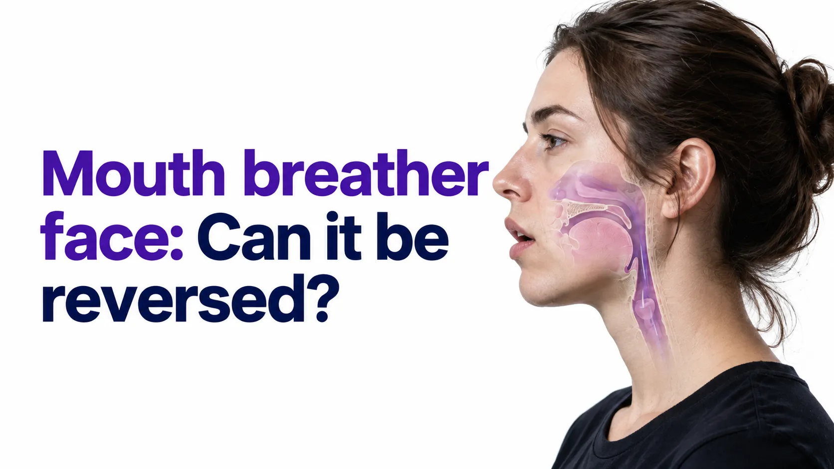 mouth breather face how chronic mouth breathing changes your face