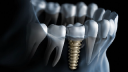 Delmarva Smile Corner, LLC