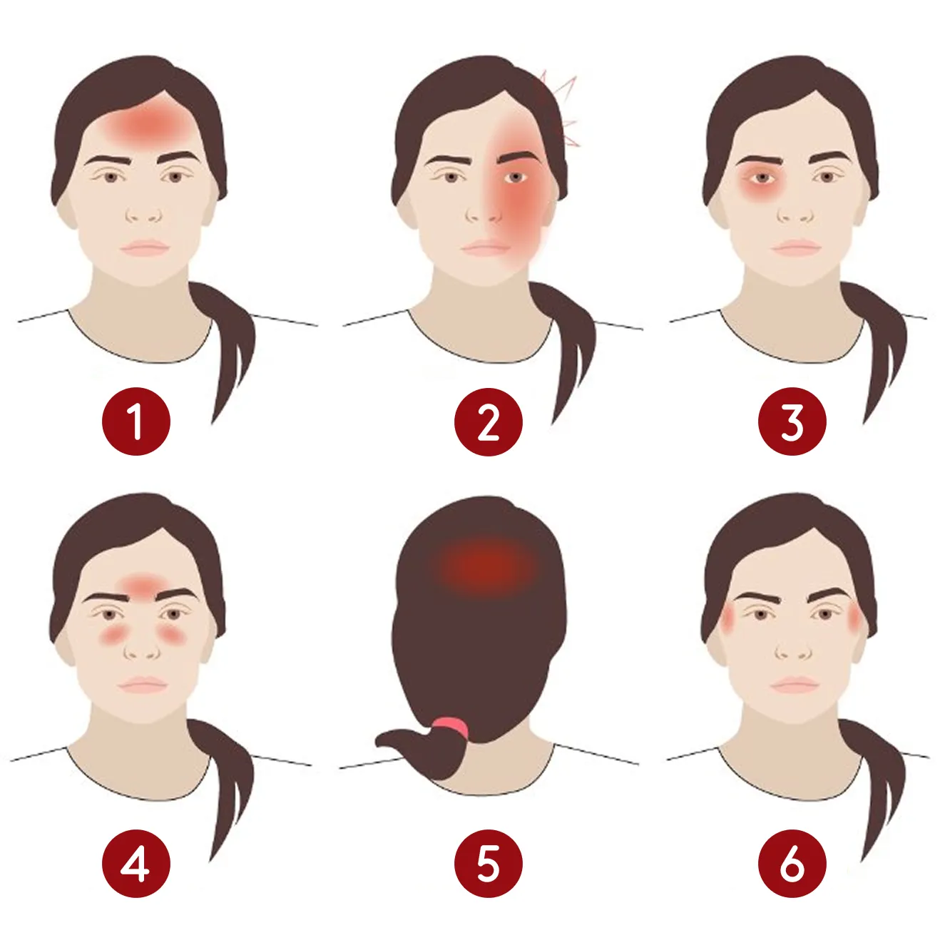 Illustration af seks forskellige hovedpineområder