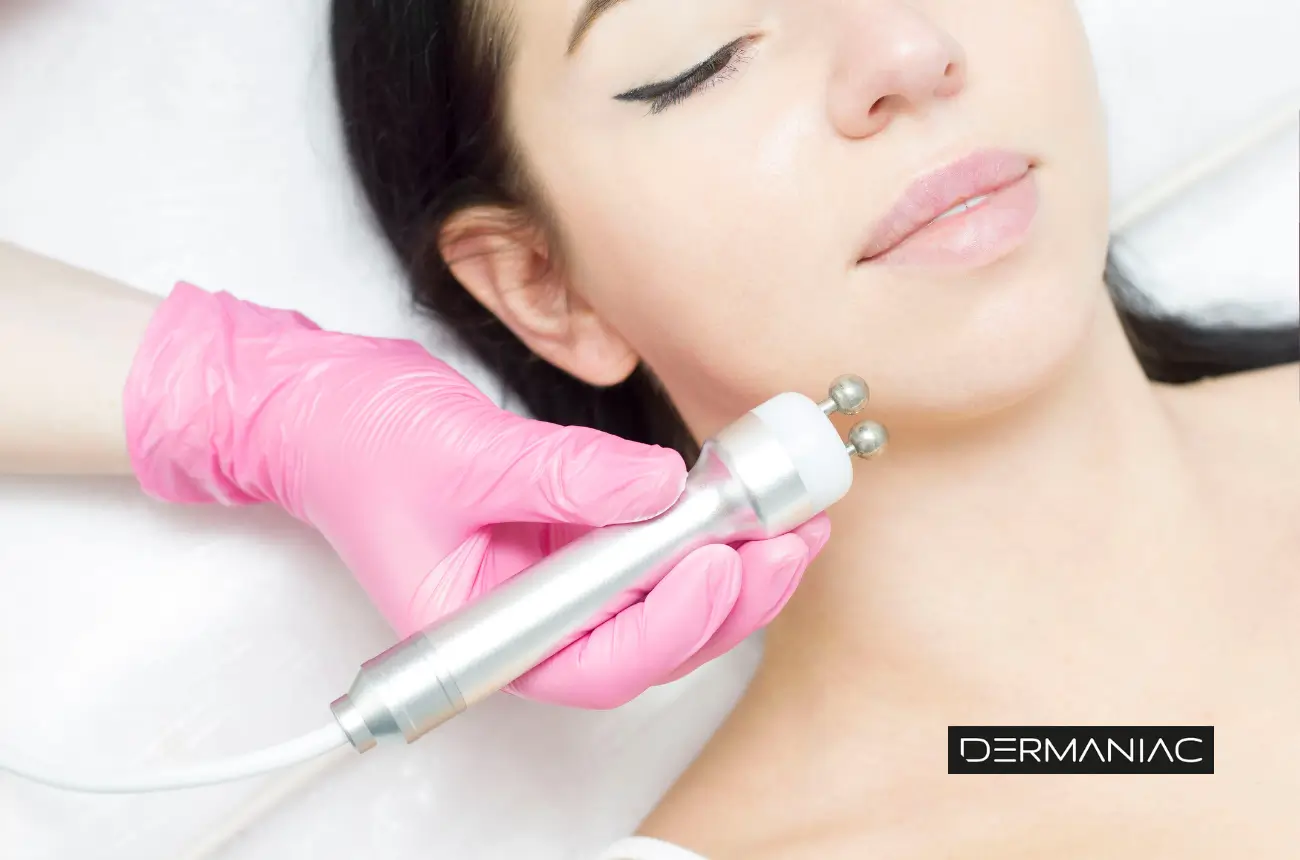 radiofrecuencia facial