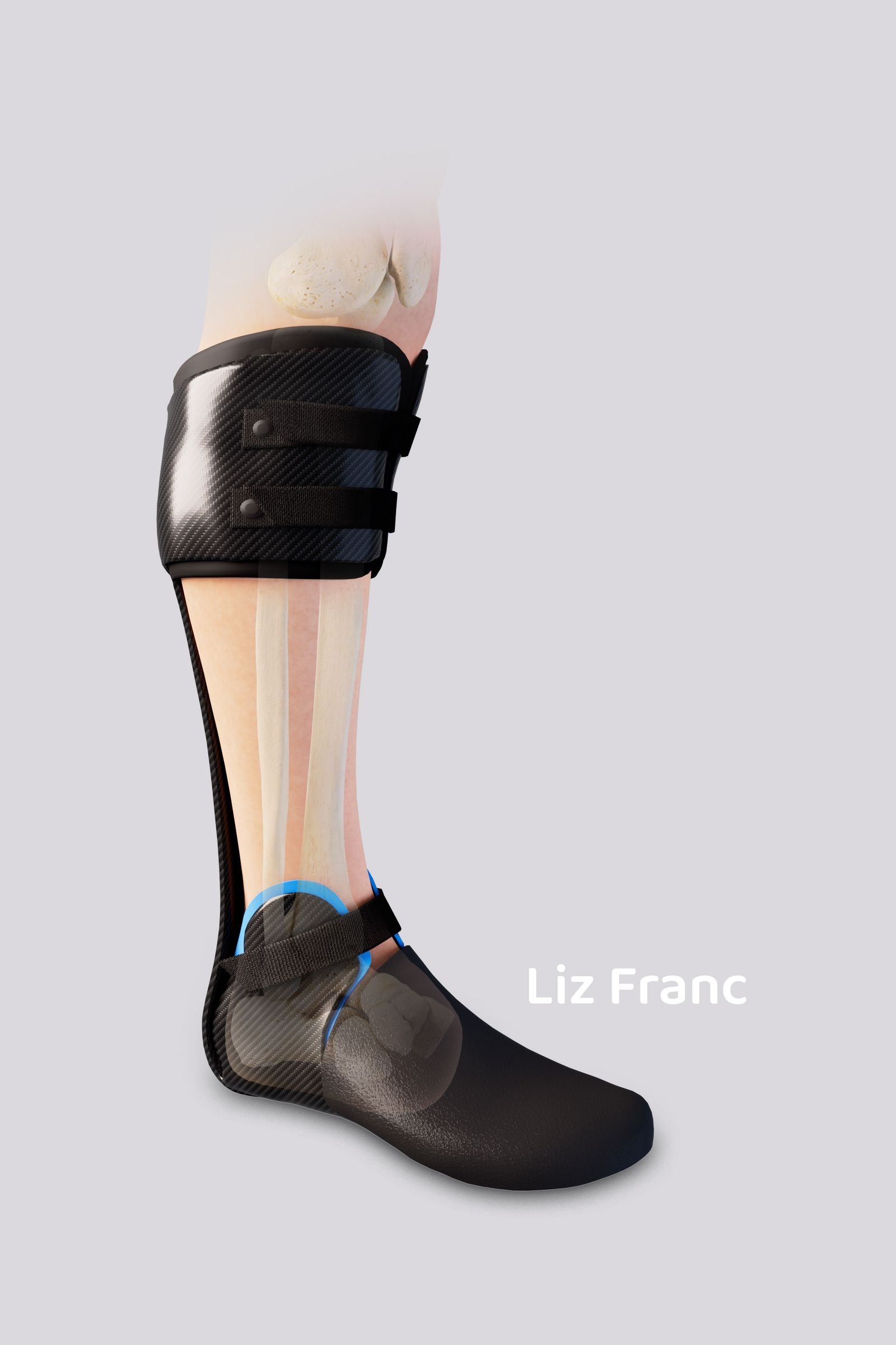 Partial Foot