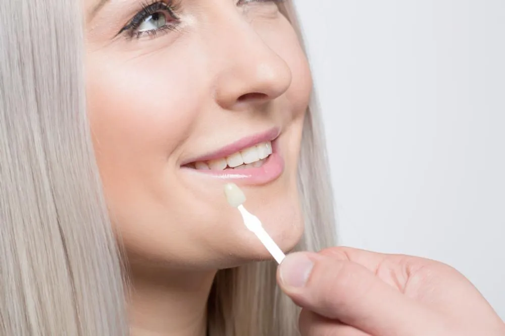 woman getting dental veneers