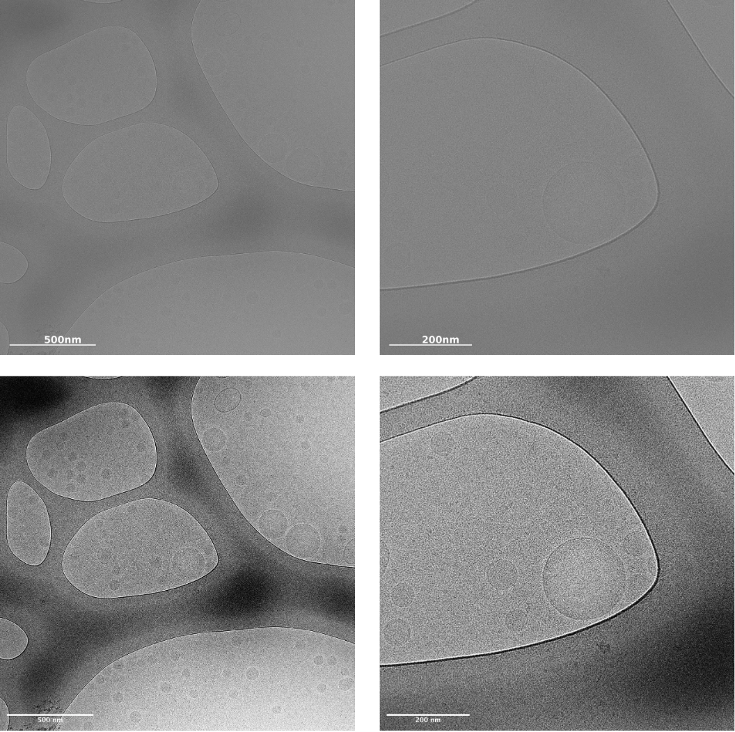 microscopic black and white TEM image showing contrast adjustments to TEM images, before & after | NIS