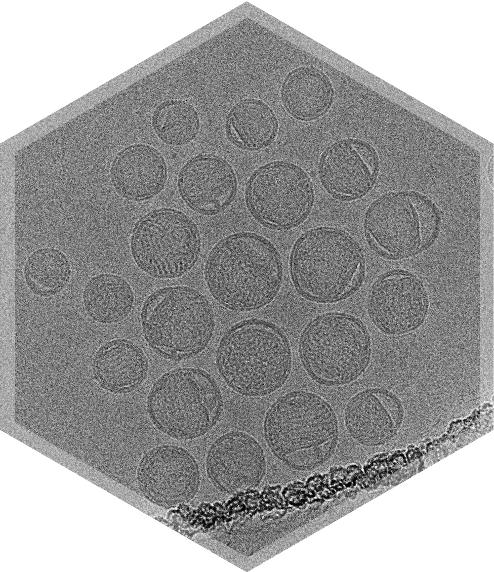 black and white cryo-tem image of lipid nanoparticle characterization