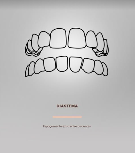 Dentes diastema